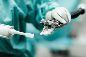 csm_makoplasty06_7414c0ac72