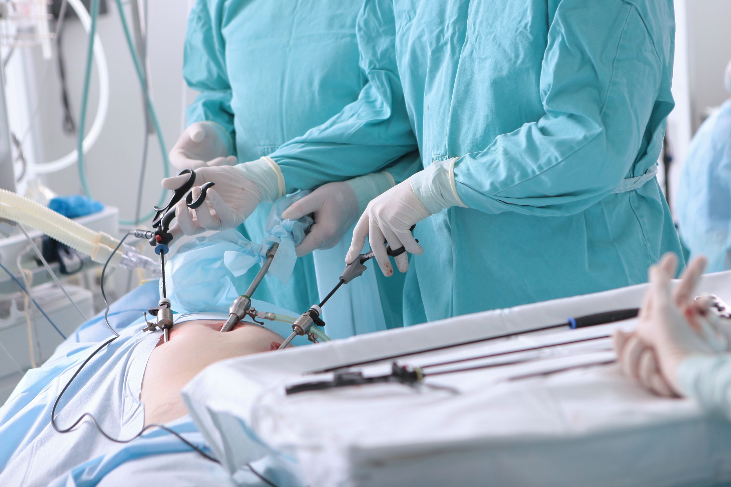 Laparoskopische Hernienchirurgie